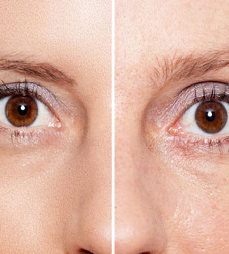 https://beautycura.com/wp-content/uploads/2020/05/microneedling_anti-aging_behandelingen_rotterdam-450x499.jpg