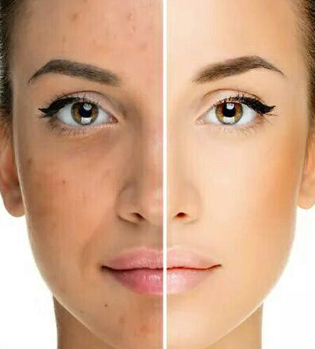 https://beautycura.com/wp-content/uploads/2020/06/mandalic-peeling-450x499.jpg